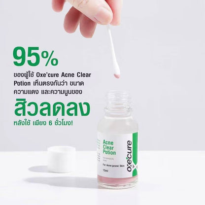 OXE’CURE ACNE CLEAR POTION 15ML สิวยุบไวมาก