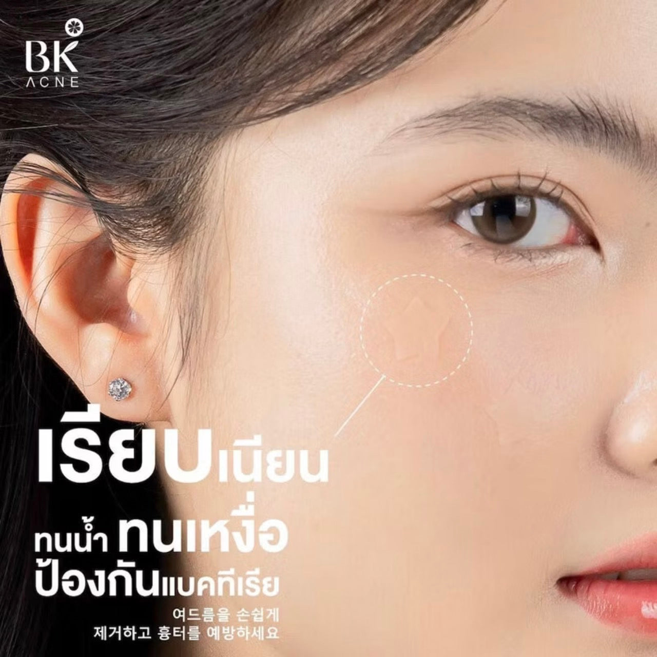 BK Acne Star Patch 12 Dots แผ่นแปะดูดซับสิว 12 ชิ้น