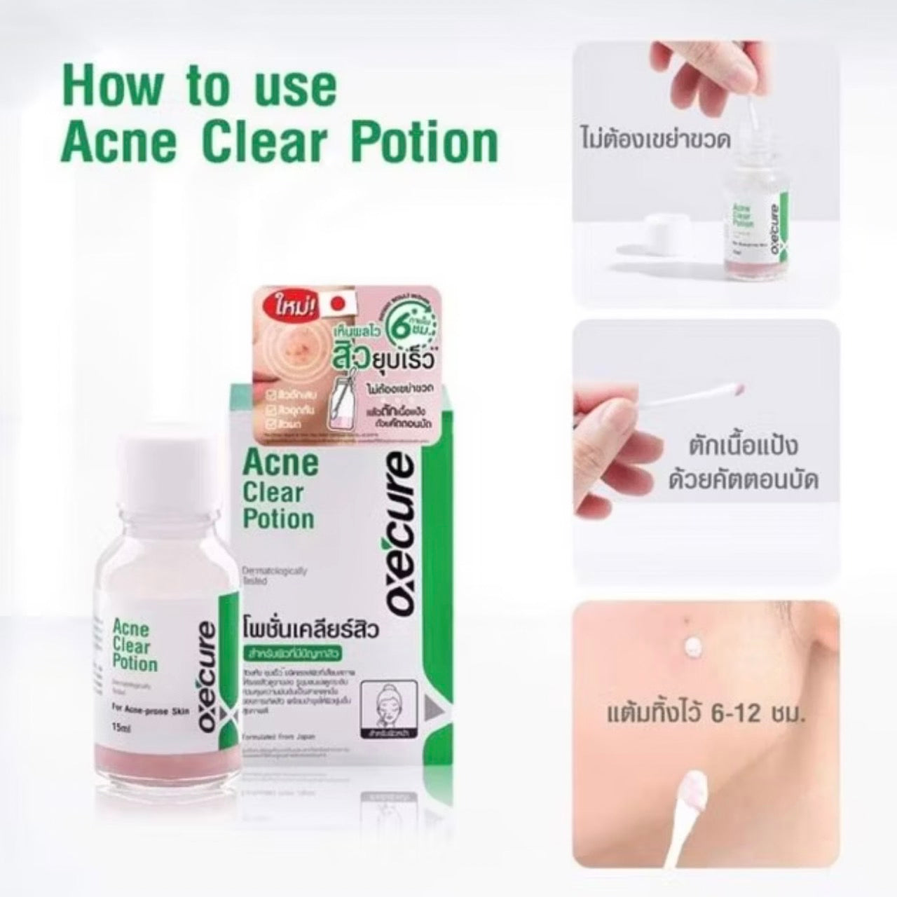 OXE’CURE ACNE CLEAR POTION 15ML สิวยุบไวมาก