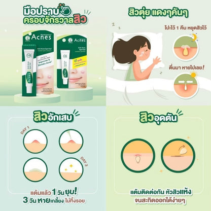 MENTHOLATUM ACNES Sealing Jell (Acne Treatment Gel) 5g. เจลแต้มสิว ยุบไวมาก