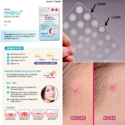 Korean Pimples Patch, Acne spot treatment sticker