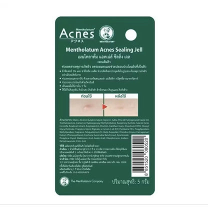 MENTHOLATUM ACNES Sealing Jell (Acne Treatment Gel) 5g. เจลแต้มสิว ยุบไวมาก