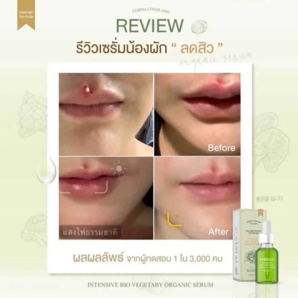 Yerpall Thailand 🥦Intensive Bio Vegetaby Organic Serum/ 🍓Strawberry YERPALL Reduce Dark Spot Acne Scar Rednes