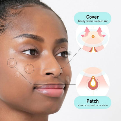 Korean Pimples Patch, Acne spot treatment sticker