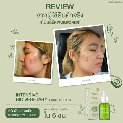 Yerpall Thailand 🥦Intensive Bio Vegetaby Organic Serum/ 🍓Strawberry YERPALL Reduce Dark Spot Acne Scar Rednes