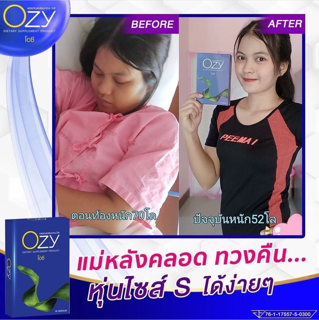 Ozy by Ning Panita Burn Fat Detox Slim Weight Control Dietary Supplement